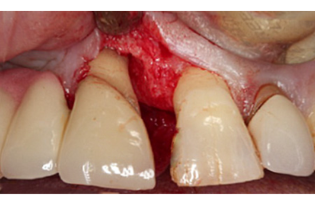 After - Periodental