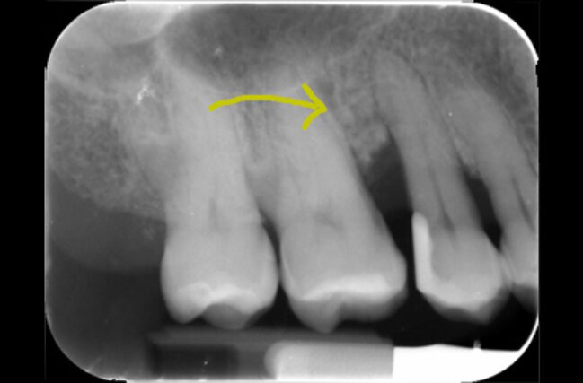 After - Periodental